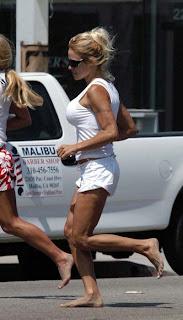 100 SEGUIDORAS!!! Y LUCHAR CONTRA LA CELULITIS I: CAUSAS Y TIPOS 100 SEGUIDORAS!!! Y LUCHAR CONTRA LA CELULITIS I: CAUSAS Y TIPOS