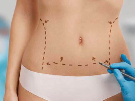 Tratamientos postoperatorios Madrid