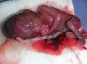 Esto "interrupción embarazo"