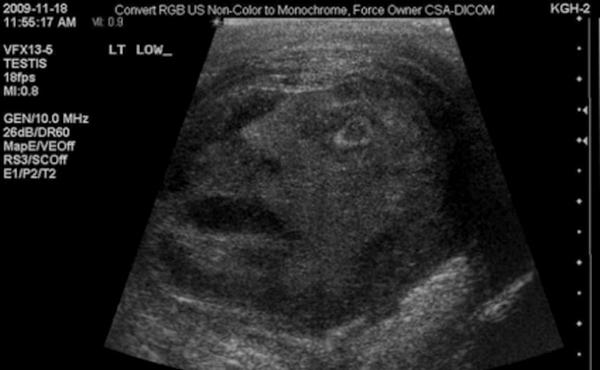 Médicos canadienses ven un “rostro” en el examen de testículos de un hombre (Foto).