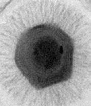 ¿ Te parecen los virus gigantes, como el hallado en Chile, seres vivos ?