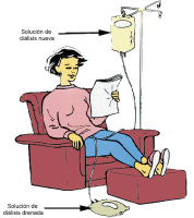 Diálisis en el salón