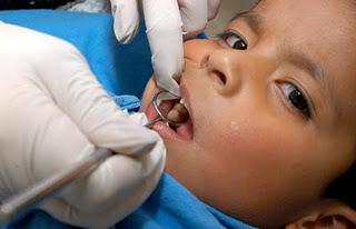 Participa IMSS en la segunda semana nacional de salud bucal en beneficio de casi un millón de niños y jóvenes