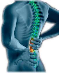 Pinzamiento vertebral