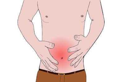 Cápsula vibratoria para tratar el estreñimiento