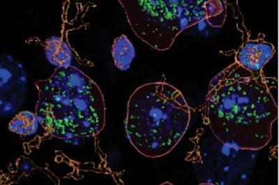 Cómo el consumo de alcohol aumenta la inflamación cerebral Cómo el consumo de alcohol aumenta la inflamación cerebral