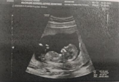 Así ha sido mi segundo embarazo Así ha sido mi segundo embarazo