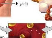 Consejos para prevenir arteroesclerosis