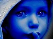 Postergación innecesaria cirugía: acto criminal (1). niño "azul"