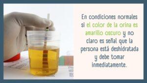 Como saber si estas bien hidratada para Controlar Peso