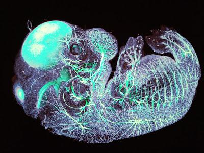 Cerebros y algoritmos