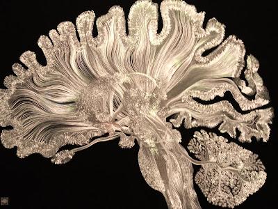 Cerebros y algoritmos