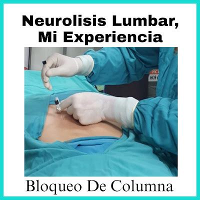 Neurolisis De Plexo Lumbar (Bloqueo De Columna)
