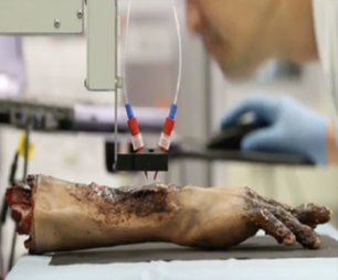 Sistema móvil de bioimpresion de piel - 3 D + Robótica