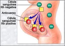 Eritroblastosis e hidropesía fetal