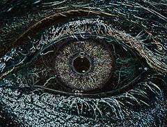 Transplante de córnea artificial