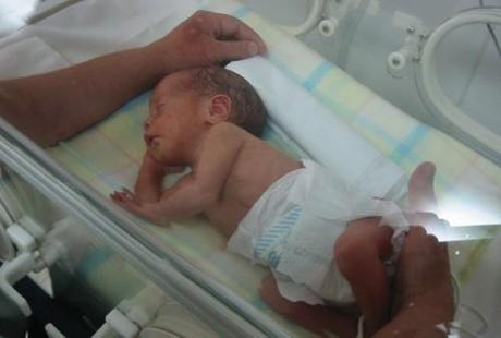 Nacimientos prematuros