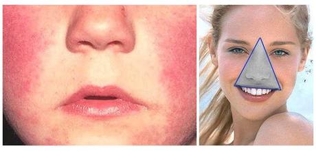 El triángulo de la muerte