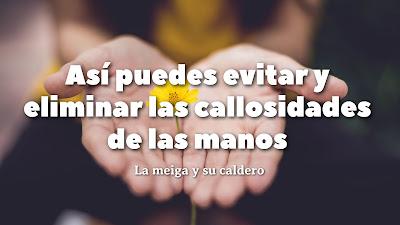 Así puedes evitar y eliminar las callosidades de las manos Así puedes evitar y eliminar las callosidades de las manos