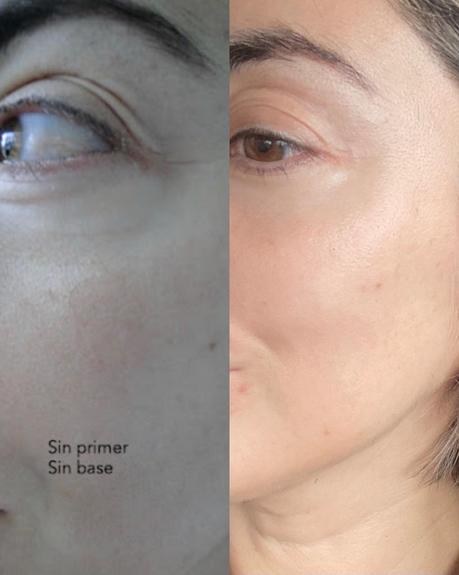 Argentina precio sesiones donde se hace Emface antes y después