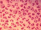 Aceleran vacuna contra gonorrea aumento casos