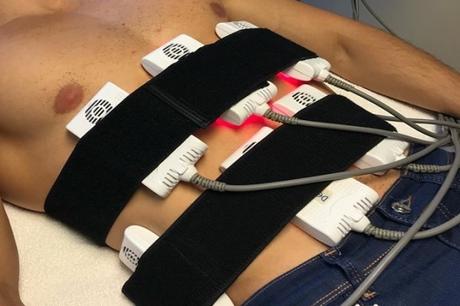 mejores clínicas de lipoláser en Barcelona