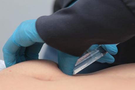 mejores clínicas de intralipoterapia en Madrid