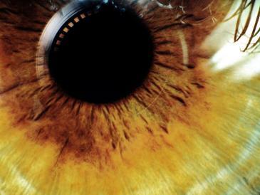 Una lentilla para ver como ‘Terminator’