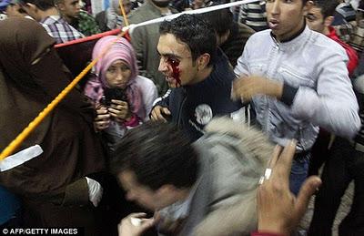 Tirador experto de la policía egipcia saca los ojos de cinco manifestantes con balas de goma (Galería de Imágenes)