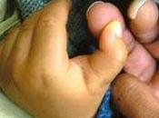 Este niño tiene pulgar atascado
