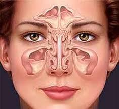 Características de la sinusitis micótica