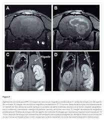 La Resonancia Magnética Metabólica La Resonancia Magnética Metabólica
