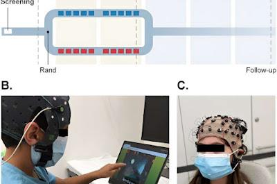 La Estimulación cerebral alivia los síntomas del TDAH