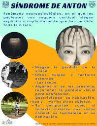 El síndrome de Antón.
