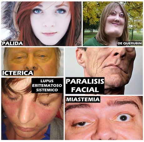 Facies