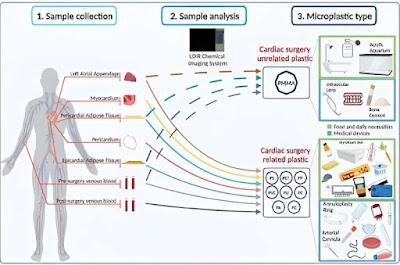 Encuentran Microplásticos en Tejidos Humanos
