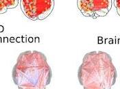 Diagnóstico autismo mediante inteligencia artificial