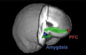 Estudio muestra diferencias de estructura y funcionamiento en el cerebro de los psicópatas