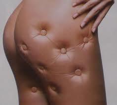 Como elegir un anticelulítico