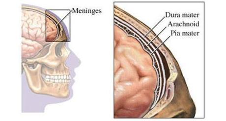 Causas y tratamiento de la meningitis