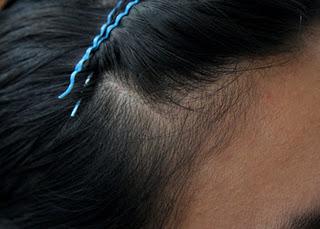 Jalar o estirar el cabello con algunos peinados provoca su caída