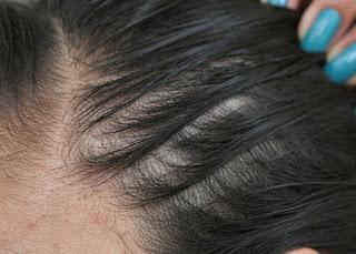 Jalar o estirar el cabello con algunos peinados provoca su caída