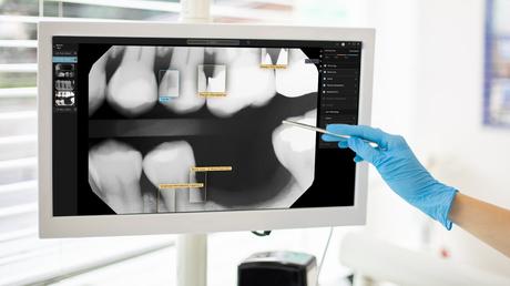 Avodent confía en la IA de Second Opinion para mejorar la experiencia de sus pacientes Avodent confía en la IA de Second Opinion para mejorar la experiencia de sus pacientes