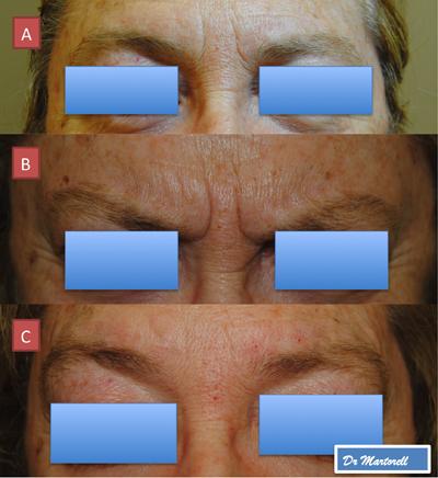 tratamiento estetico consultaclick