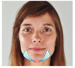 ¿Papada? No, gracias