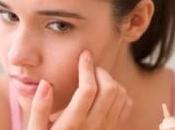 granitos acné afectan solo jóvenes