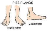 Ejercicio Pilates para los pies planos