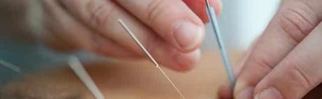 ¿Cómo la acupuntura puede ayudar a las migrañas? tratamiento migrañas