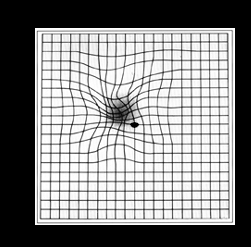 La cartilla de Amsler.