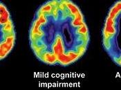 Avances diagnósticos contra Alzheimer